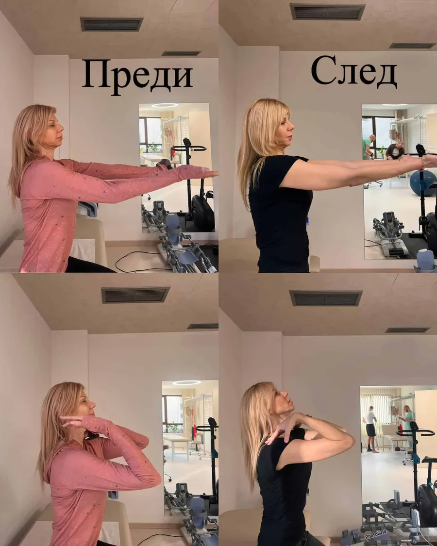 Силвия — възстановяване след счупване на лакътна става